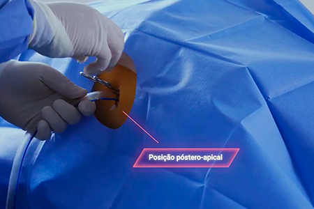 [SF] aula-procedimentos