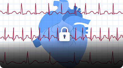 sf-Eletrocardiograma-1